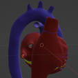 12.png 3D Model of Heart with Transposition of the Great Arteries, long axis view
