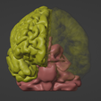 2.png 3D Model of Brain