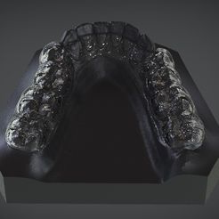1.jpg STL file Digital Mandibular Decompression Splint・Template to download and 3D print
