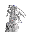 Captura-de-Pantalla-2023-12-10-a-la-s-7.14.29-p. m.png aortic aneurysm - AORTA ANEURYSM