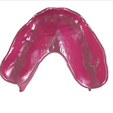 20.png Digital Full Dentures with Combined Glue-in Teeth Arch