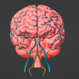1.png 3D Model of Brain and Aneurysm