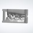 Clipboard-2024-06-11-14-08-05.jpg 10 DENTAL STUDY MODELS - REAL PATIENTS, UPPER AND LOWER 3D MODELS WITH ADDITIONAL DIES