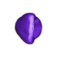 2.stl dental partial dentures