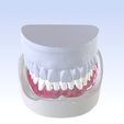 7.jpg Digital Single Jaw Full Denture