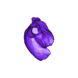STL00004.stl 3D Model of Human Heart with Double Superior Vena Cava (DSVC) - generated from real patient