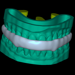 FullModel.png STL file Dental Model BiteSplint・3D printer model to download