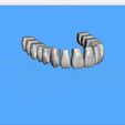 Dentes-Maxila-Alternative-Exocad-01.jpg Teeth Upper Jaw - Exocad - Alternative