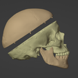 10.png 3D Model of Skull and Brain with Brain Stem