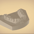 Screenshot_22.png Digital Orthodontic Study Models with Virtual Bases
