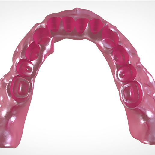 Screenshot_9.png Download OBJ file Digital Full Dentures for Gluedin Teeth with Manual Reduction • 3D printable design, LabMagic3DCAD