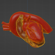 uv4.png 3D Model of Heart with Atrial Septal Defect
