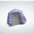 Clipboard-2024-02-25-15-30-56.jpg DIGITAL BLEACHING TRAYS - 4 STL FILES (UPPER AND LOWER TRAY) + 3D MODELS !!!