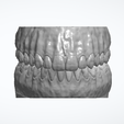 UP-and-LOW.png Full Arch Dental Study Model with Roots and Alveolar Bone (STL)