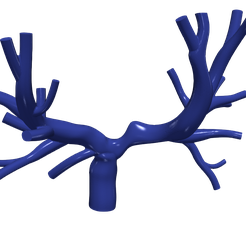 chd1.png.fba5315a9584977e6c5f0d25a7ae0f15.png Modèle 3D des artères pulmonaires (procédure Fontan)