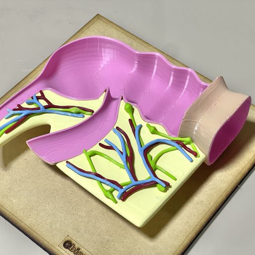 appendix-anatomy3.jpeg Cecal appendix anatomy