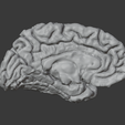 brain_normal_lh2.png NORMAL HUMAN BRAIN MODEL 1:1