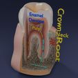 image-0031.jpg Corte esquemático de los dientes etiquetado