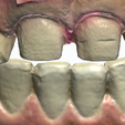 IO-Data-Pack-Pic.png Dental Design Practice - Intraoral  Scans