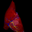4.png 3D Model of Heart wirh Atrioventricular Septal Defect, 4 chamber view