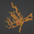 w8.png 3D Model of Middle Cerebral Artery (MCA) Aneurysm
