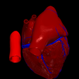 3.png 3D Model of the Heart with Tetralogy of Fallot, parasternal long axis