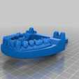 d068ec69-2c6b-48d7-82a5-81bd3be8d56a.png Mouth Chip Clip from 3D Scan of Teeth