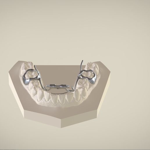 Snapshot_2017-3-1_13-13-24.jpg Digital Dr. Williams's Ortho Appliance
