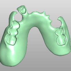 Clipboard-2024-02-25-15-32-59.jpg DIGITAL FLEXIBLE PARTIAL DENTURES (upper + lower jaw + artificial teeth)