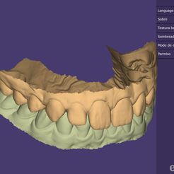 O3D.jpg MAXILAR SUP AND INF MAXILAR INTRAORAL SCAN - AREA3D - Patient A.