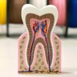 8e8b6428-3bb4-4512-a80d-d9beac15f8a6.jpg Healthy Tooth Model