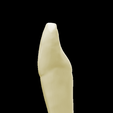 12.png Left Lower Lateral Lateral Incisor #32