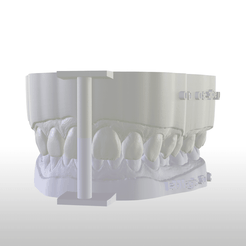 Screenshot_7.png Digital Dental Unsectioned Study Model