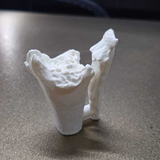 WhatsApp-Image-2025-06-04-at-4.22.10-PM.jpeg Tibia and Fibula