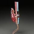 renal-cell-carcinoma-3d-model-13603f8f38.jpg Renal cell carcinoma 3D model