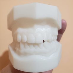 yo-1.jpg Complete Denture