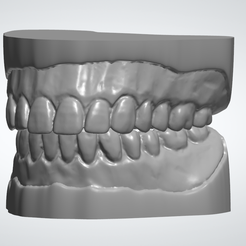 Screenshot-2024-05-20-173223.png Denture study models
