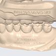 MeditLink_Image_Data_-3.jpg MODELO PEDAGÓGICO DR CAPARACHINI STRAUMANN - NEODENT (INCLUINDO ANÁLOGOS)