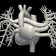 5.png 3D Model of Heart with Vessels