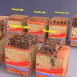 5.jpg adaptation epithelial cell changes normal to cancer Low-poly 3D model