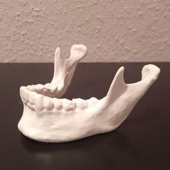 275941537_1817618128435874_602161115440655736_n.jpg Fichier STL Anatomie de la mâchoire humaine・Modèle pour imprimante 3D à télécharger