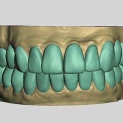 MAGEncerado-7.jpg Ready-to-print dental practice models
