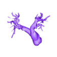 STL00007.stl 3D Model of Human Heart with Double Outlet Right Ventricle (DORV) - generated from real patient