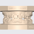 Captura-de-pantalla-2024-02-19-222435.png ARTICULATED UPPER AND LOWER DENTAL MODEL (10)