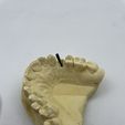 8.jpg Dental Pins STL