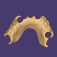 Clipboard-2025-05-07-23-27-19.jpg DIGITAL FLEXIBLE PARTIAL DENTURE (upper base + artificial teeth)
