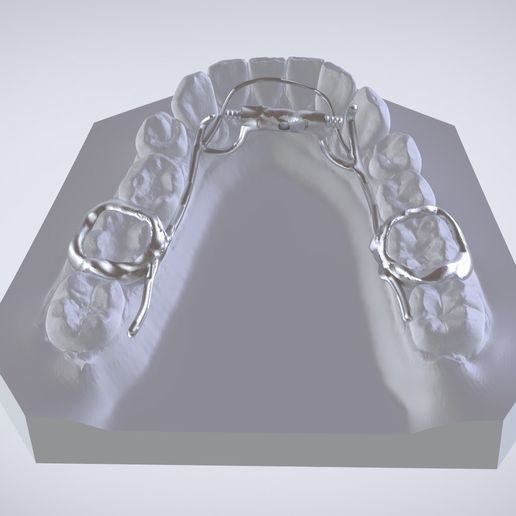 Snapshot_2017-3-1_13-4-55.jpg Digital Dr. Williams's Ortho Appliance
