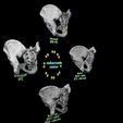 pelvis-types-hip-bone-labelled-detailed-3d-model-a6745b4282.jpg Pelvis types hip bone labelled detailed 3D model