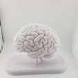 20251231_113136-1.jpg Sección transversal del cerebro