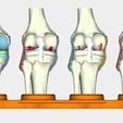 3.jpg total knee replacement model ( TKR ), EDUCATING / TEACHING MODEL